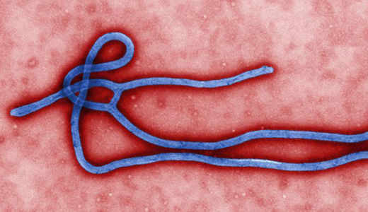 警惕最新病毒病人，你需要了解這些關(guān)鍵信息！