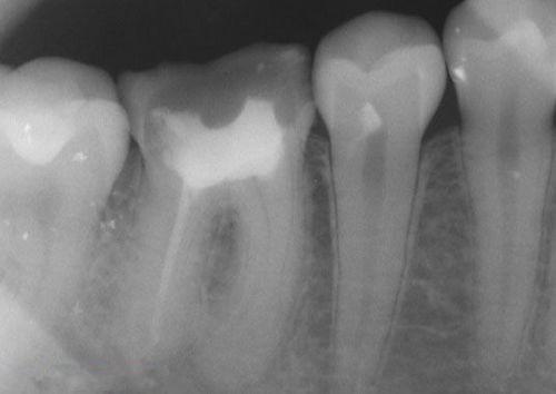 中國再生牙齒研究新進展，重塑微笑，科技引領牙齒再生新篇章